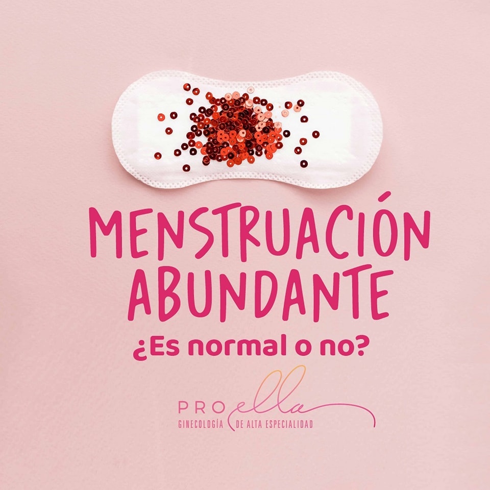 Menstruación abundante